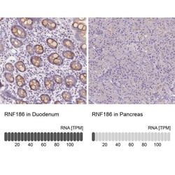 RNF186 Antibody, Novus Biologicals 0.1mL; Unlabeled:Antibodies, Polyclonal